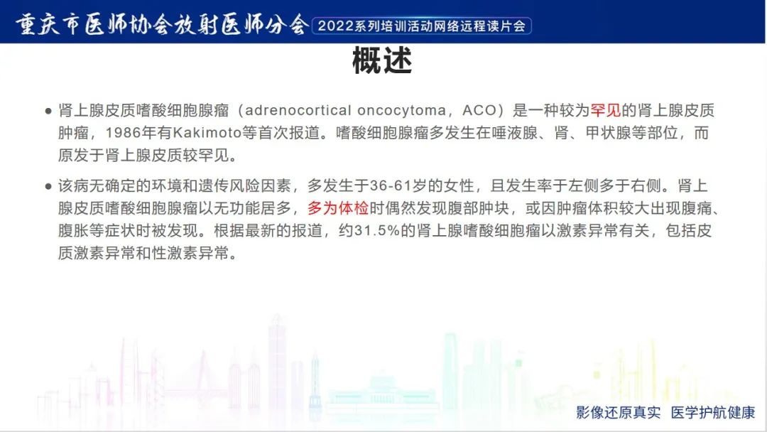 影像PPT - 【病例】肾上腺皮质嗜酸细胞腺瘤1例CT-13