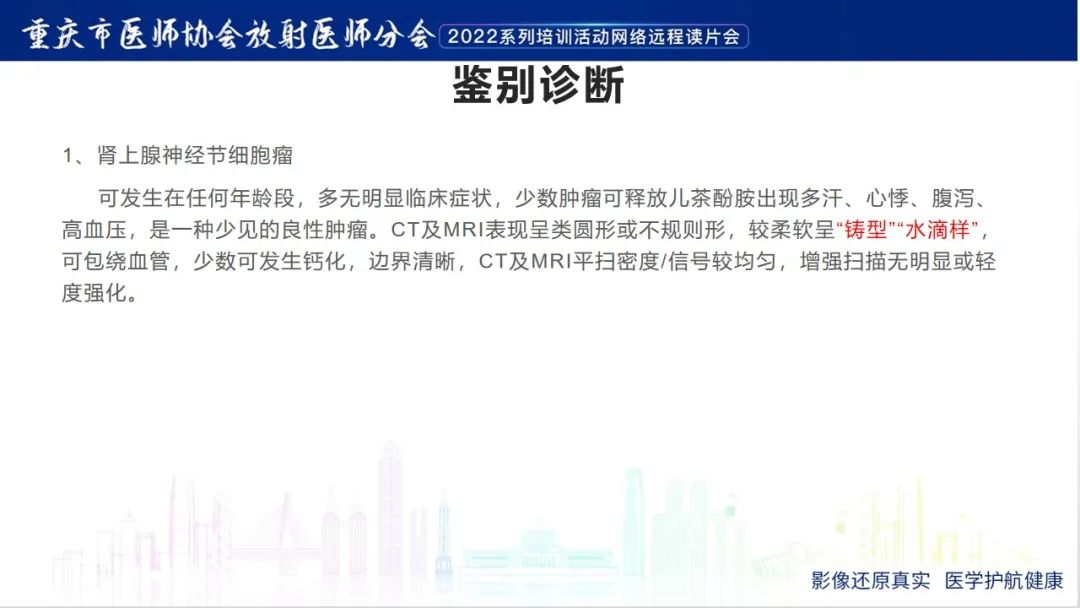 影像PPT - 【病例】肾上腺皮质嗜酸细胞腺瘤1例CT-22