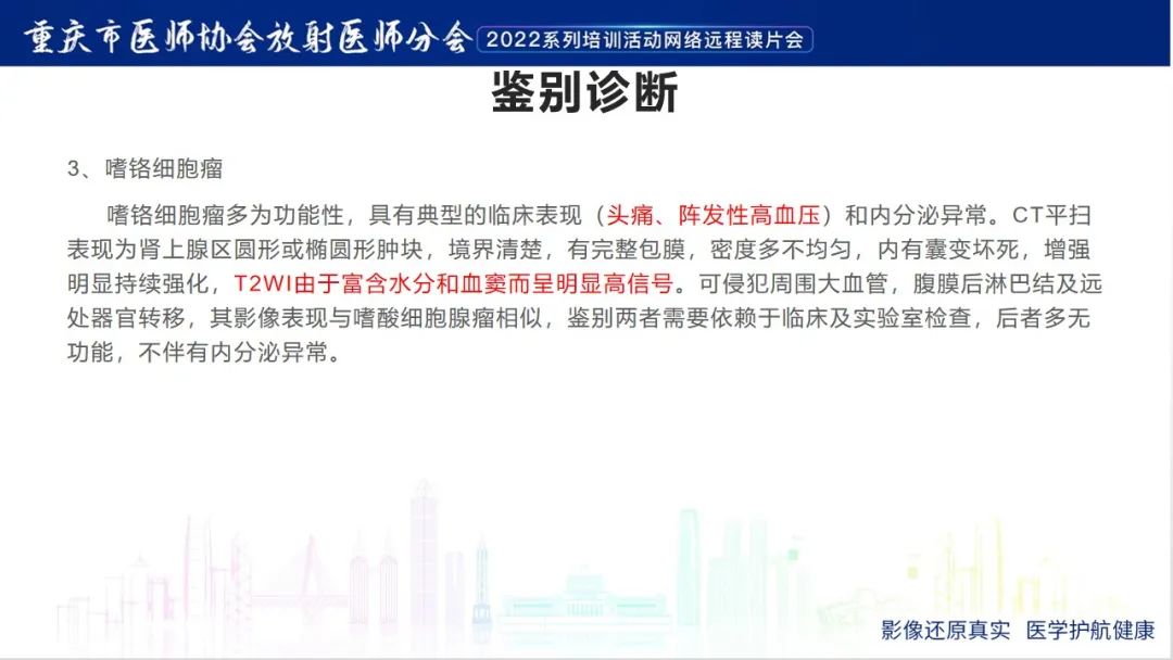 影像PPT - 【病例】肾上腺皮质嗜酸细胞腺瘤1例CT-26
