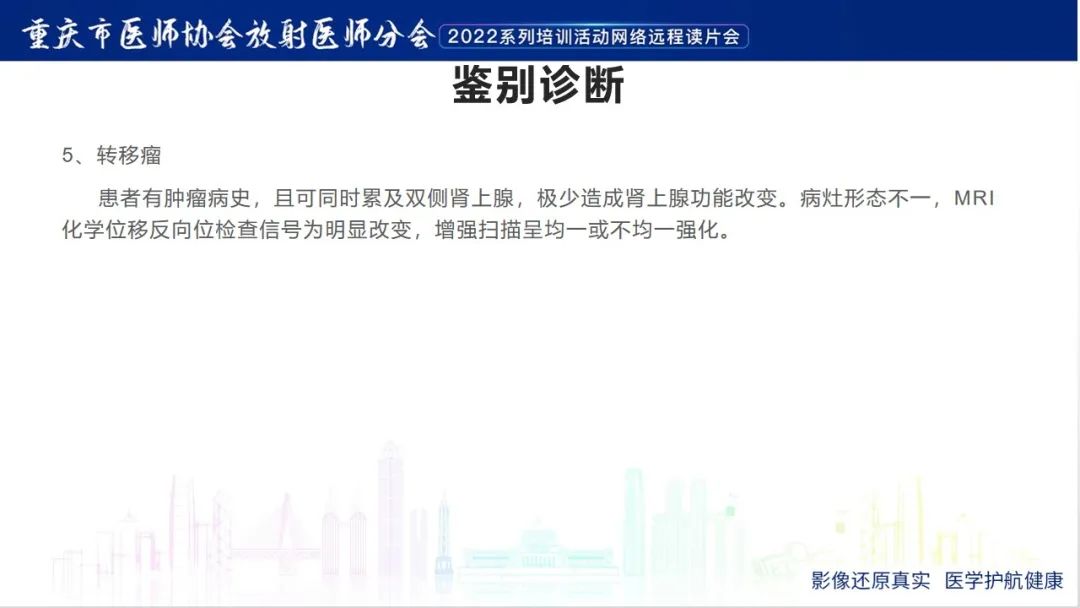 影像PPT - 【病例】肾上腺皮质嗜酸细胞腺瘤1例CT-30