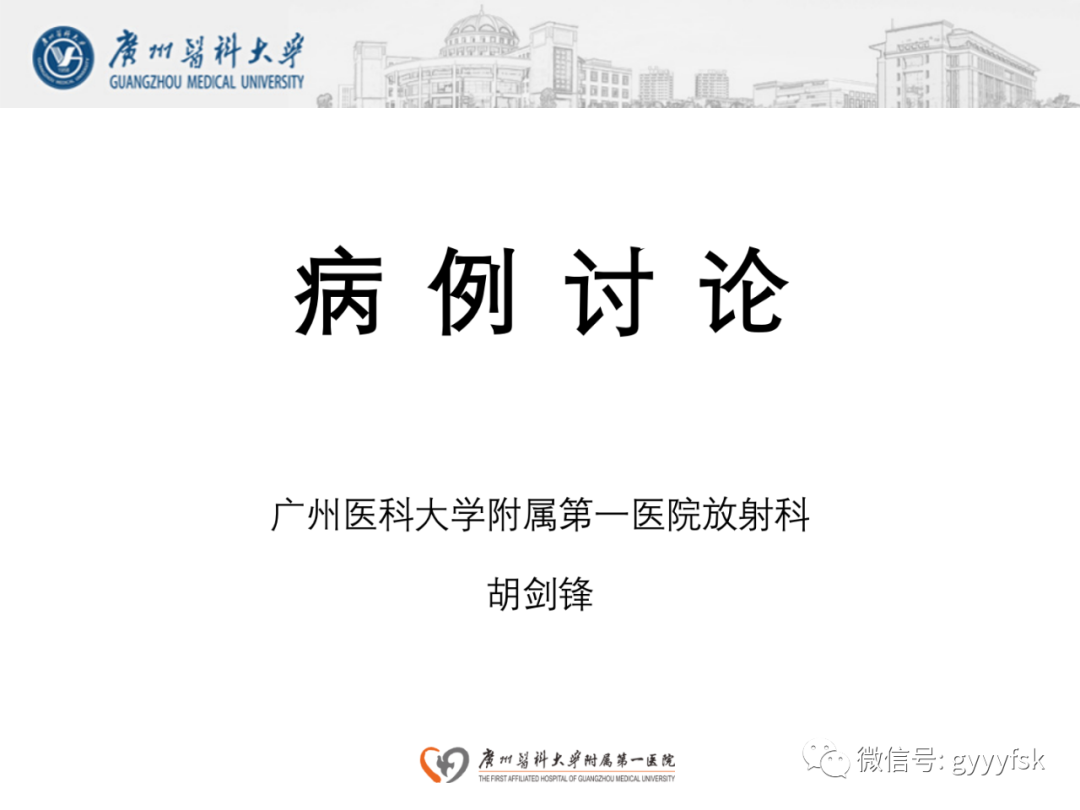 影像PPT - 【病例】纵隔淋巴瘤弥漫大B细胞淋巴瘤1例CT影像-1