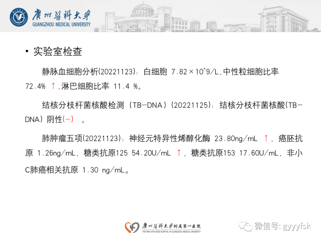 影像PPT - 【病例】纵隔淋巴瘤弥漫大B细胞淋巴瘤1例CT影像-3