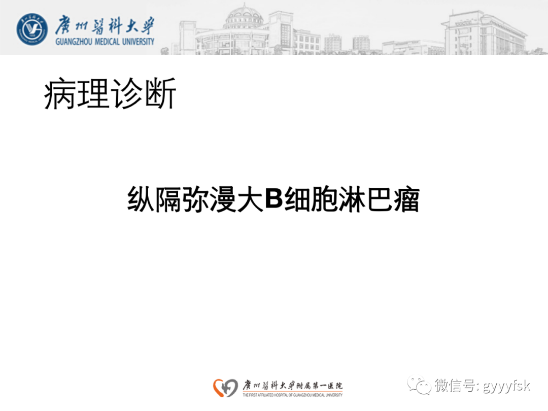 影像PPT - 【病例】纵隔淋巴瘤弥漫大B细胞淋巴瘤1例CT影像-11