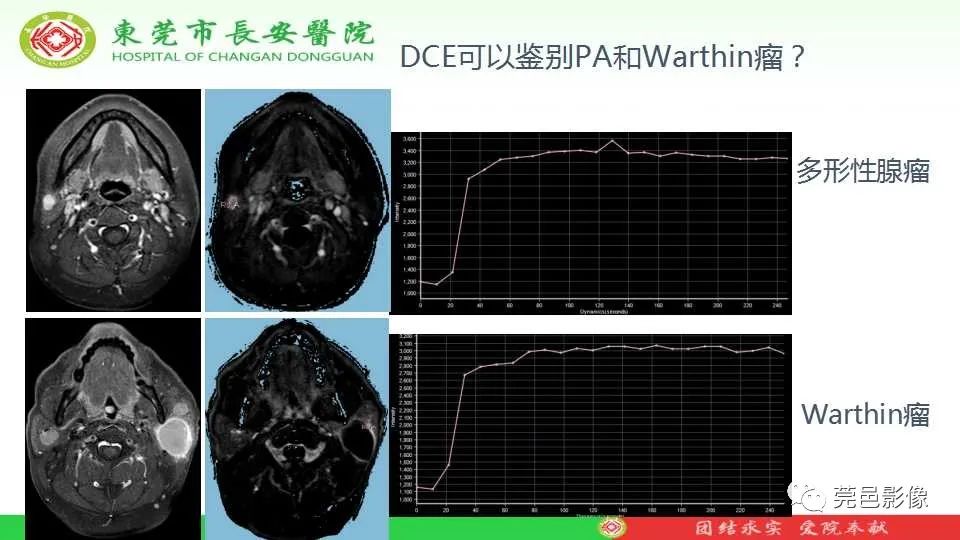 影像PPT - 【PPT】IVIM-DWI多参数鉴别多形性腺瘤和Warthin瘤-9