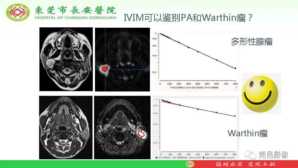 影像PPT - 【PPT】IVIM-DWI多参数鉴别多形性腺瘤和Warthin瘤-13