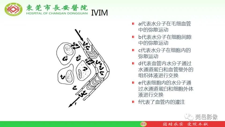影像PPT - 【PPT】IVIM-DWI多参数鉴别多形性腺瘤和Warthin瘤-18