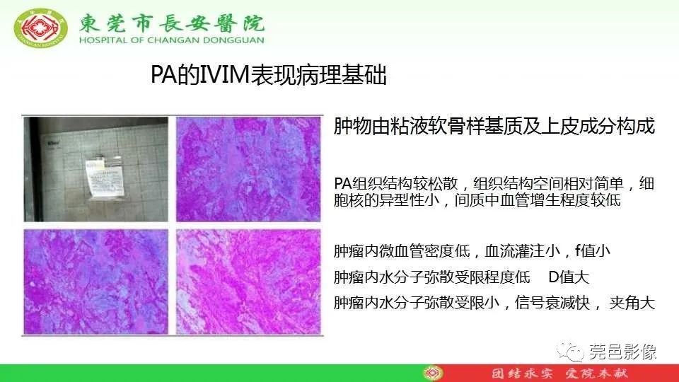 影像PPT - 【PPT】IVIM-DWI多参数鉴别多形性腺瘤和Warthin瘤-34