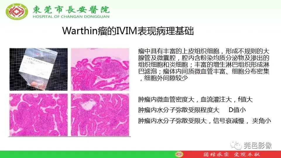 影像PPT - 【PPT】IVIM-DWI多参数鉴别多形性腺瘤和Warthin瘤-35