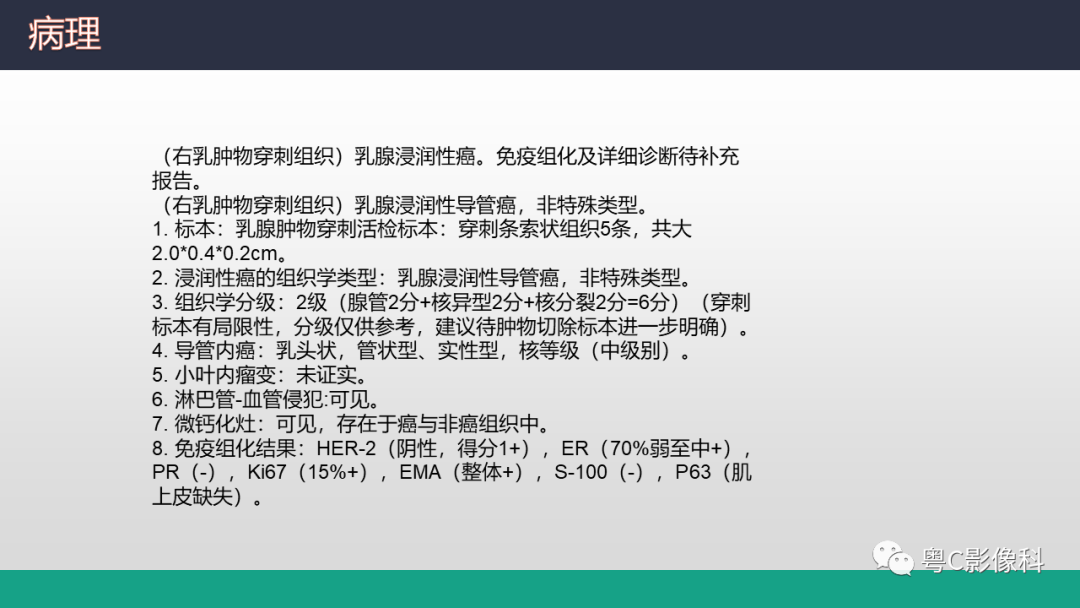 影像PPT - 【病例】浸润性乳腺癌1例X线钼靶MR影像表现-14