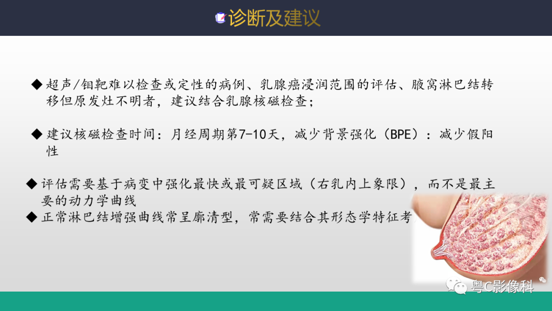 影像PPT - 【病例】浸润性乳腺癌1例X线钼靶MR影像表现-8