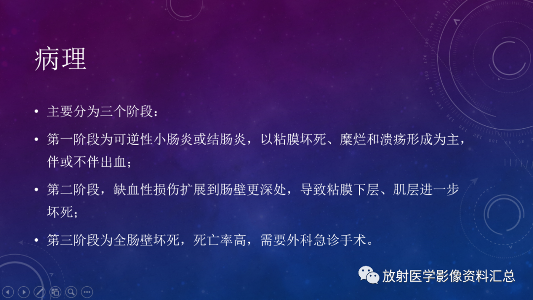 影像PPT - 【PPT】急性肠系膜缺血的CT影像诊断-3