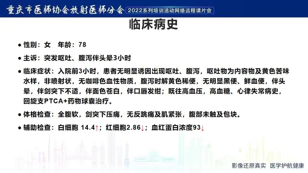 影像PPT - 【病例】腹腔胃大弯旁血肿1例CT影像-2