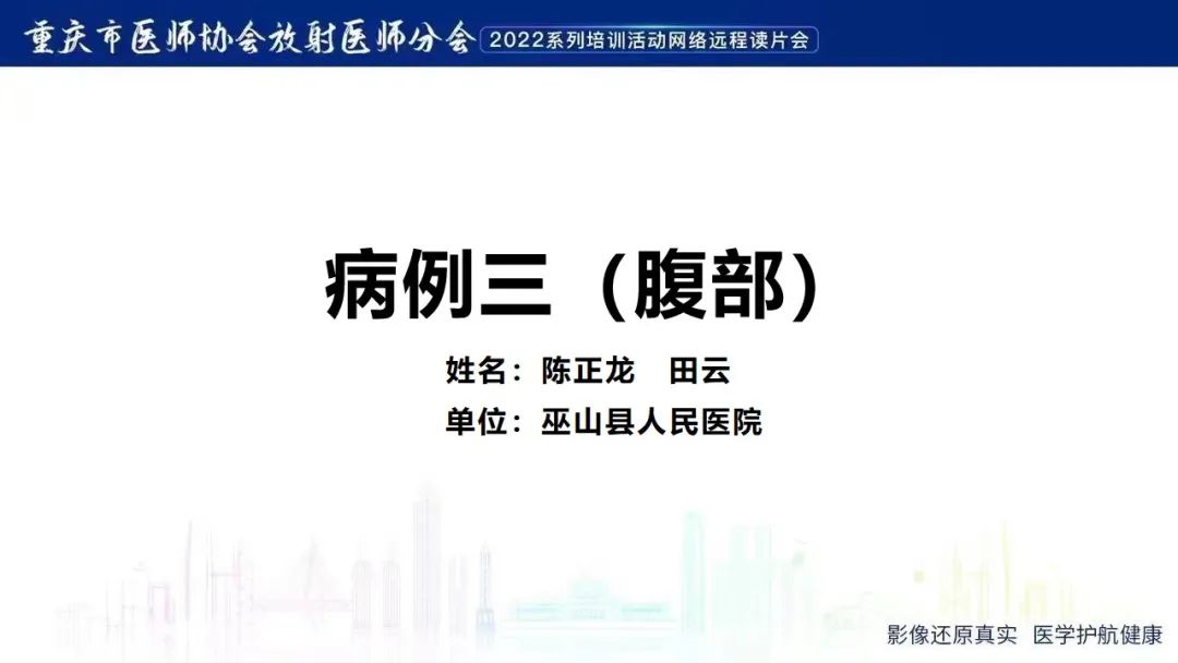 影像PPT - 【病例】腹腔胃大弯旁血肿1例CT影像-1