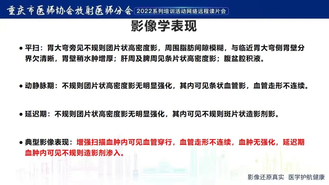 影像PPT - 【病例】腹腔胃大弯旁血肿1例CT影像-13