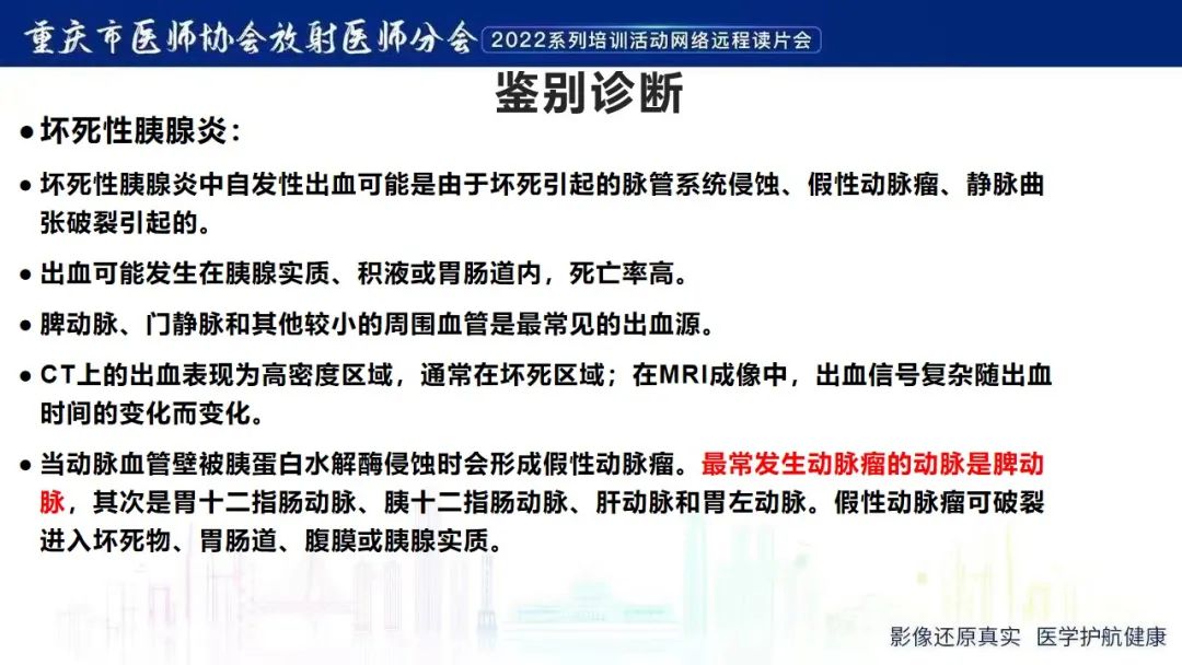 影像PPT - 【病例】腹腔胃大弯旁血肿1例CT影像-21