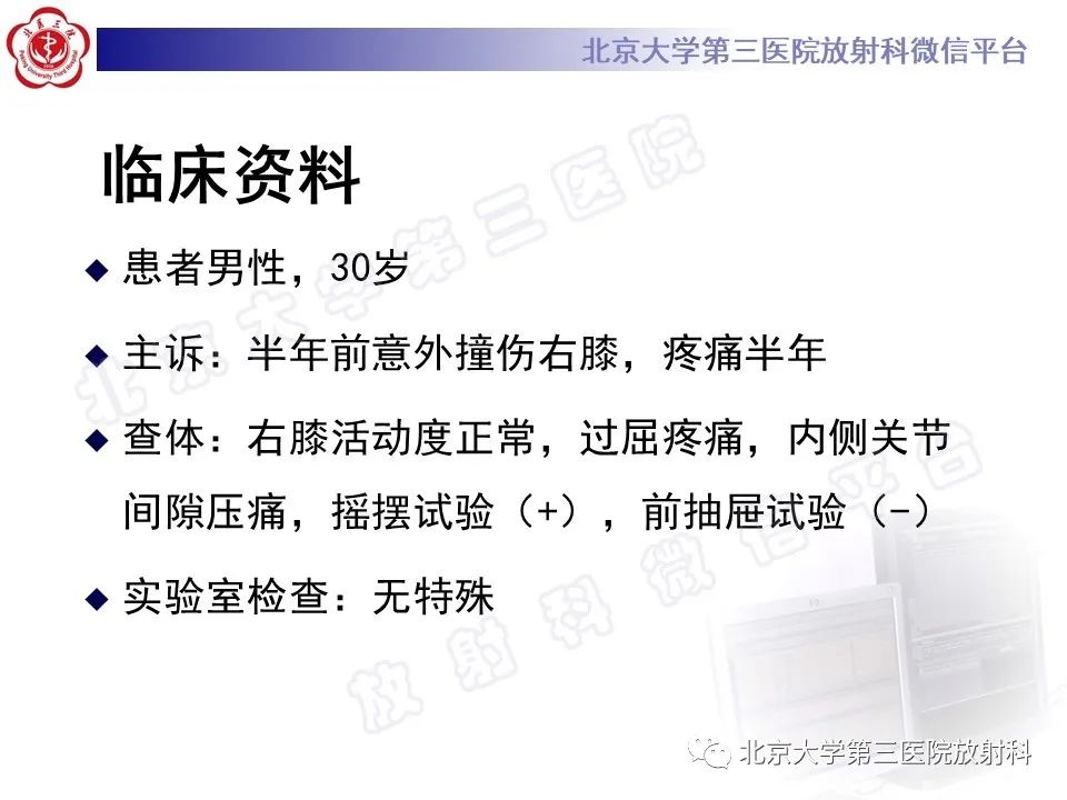 影像PPT - 【PPT】半月板撕裂的影像学诊断-2