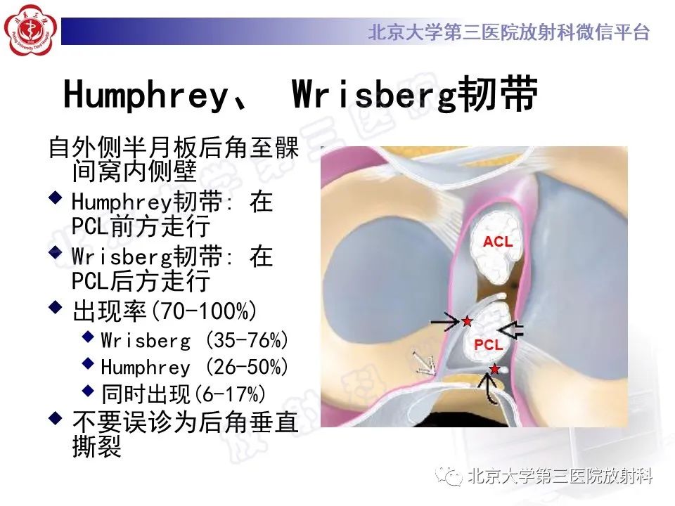 影像PPT - 【PPT】半月板撕裂的影像学诊断-15