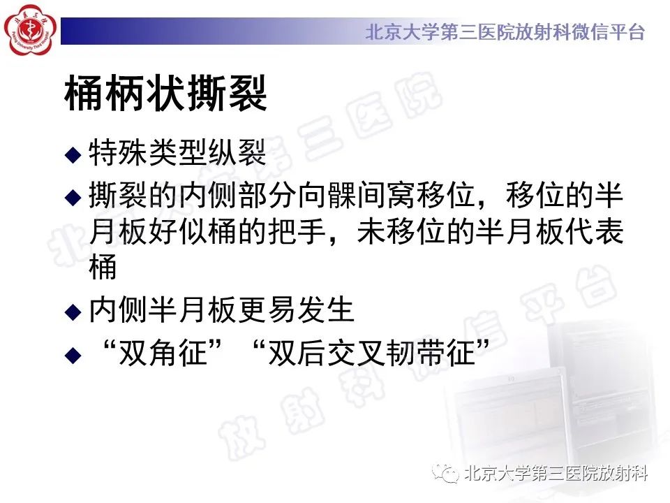 影像PPT - 【PPT】半月板撕裂的影像学诊断-27