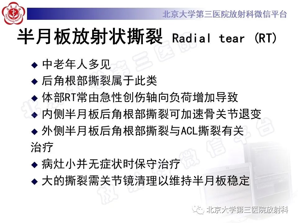 影像PPT - 【PPT】半月板撕裂的影像学诊断-28