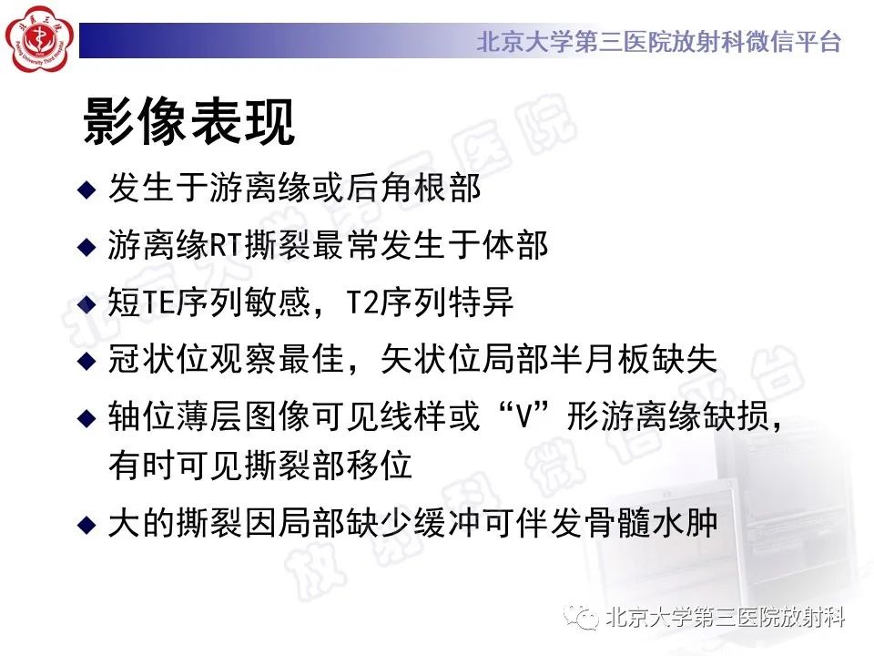 影像PPT - 【PPT】半月板撕裂的影像学诊断-29
