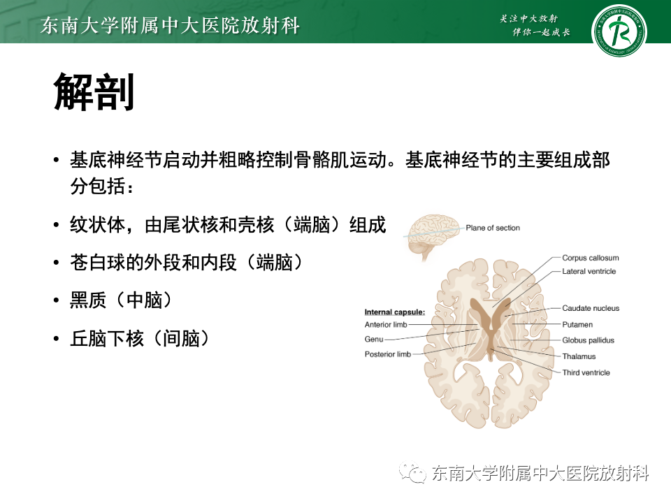 影像PPT - 【PPT】肝性脑病的影像学表现-4