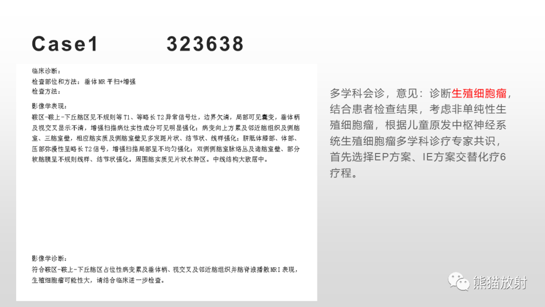 影像PPT - 【PPT】颅内生殖细胞瘤-10
