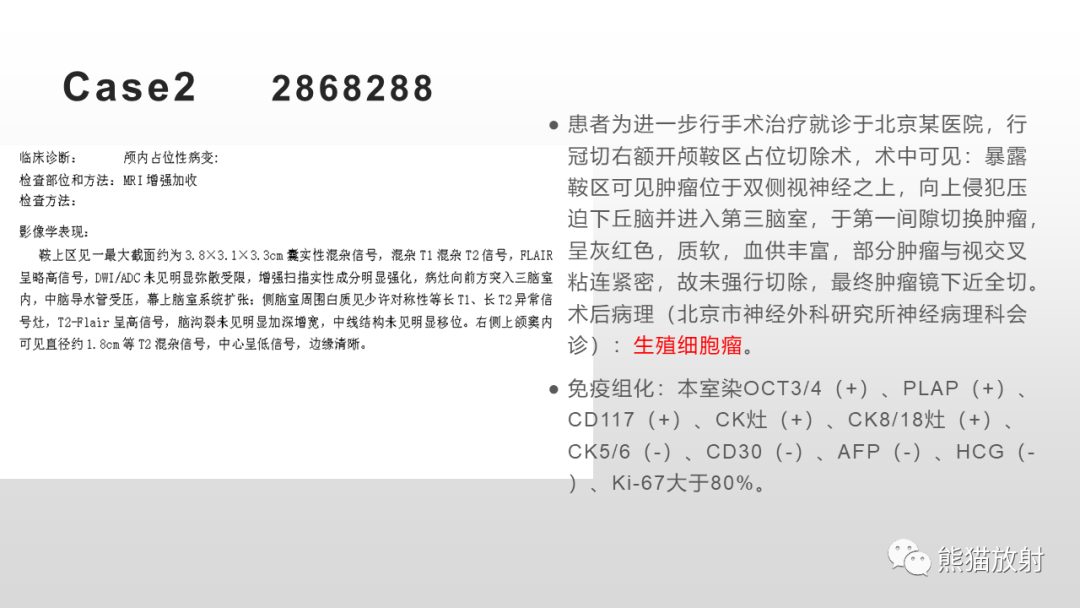 影像PPT - 【PPT】颅内生殖细胞瘤-12