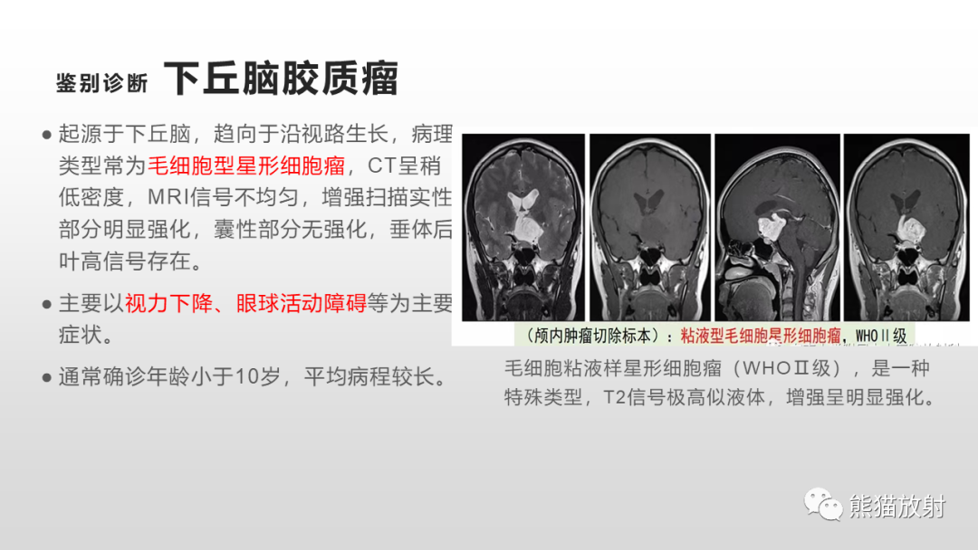 影像PPT - 【PPT】颅内生殖细胞瘤-21