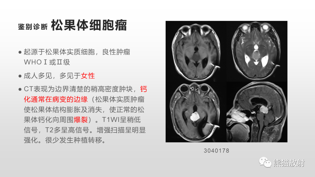 影像PPT - 【PPT】颅内生殖细胞瘤-24