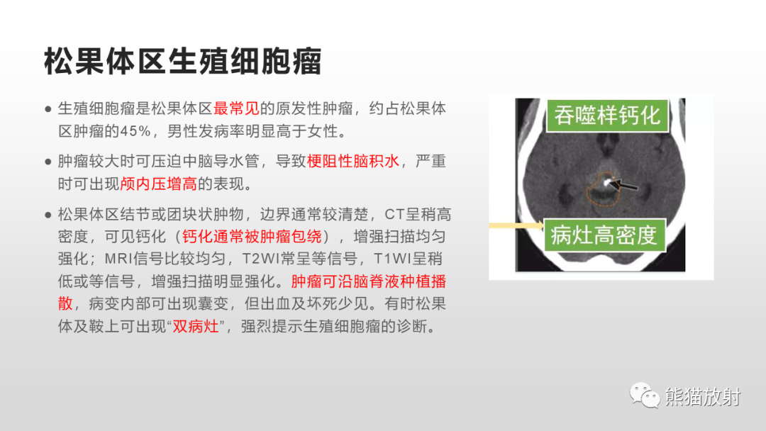 影像PPT - 【PPT】颅内生殖细胞瘤-22