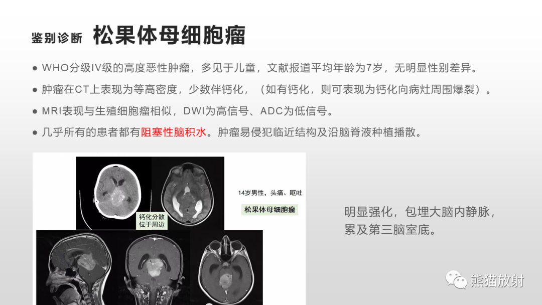 影像PPT - 【PPT】颅内生殖细胞瘤-25