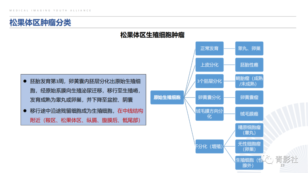 影像PPT - 【PPT】松果体区肿瘤性病变影像诊断-19