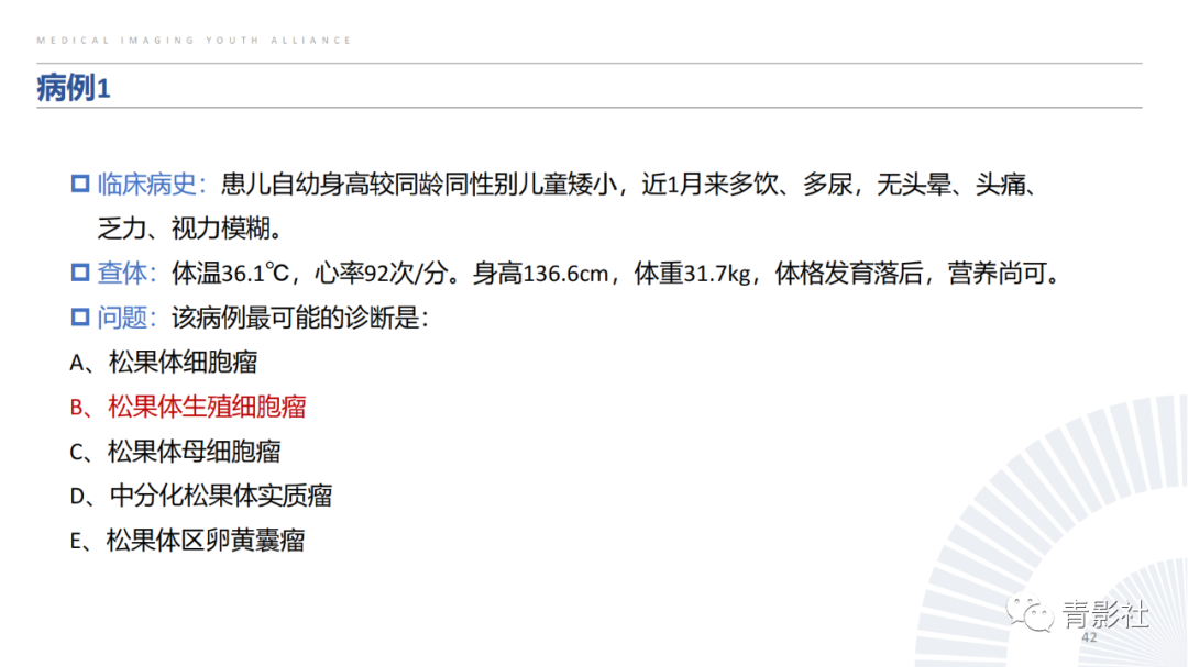 影像PPT - 【PPT】松果体区肿瘤性病变影像诊断-42