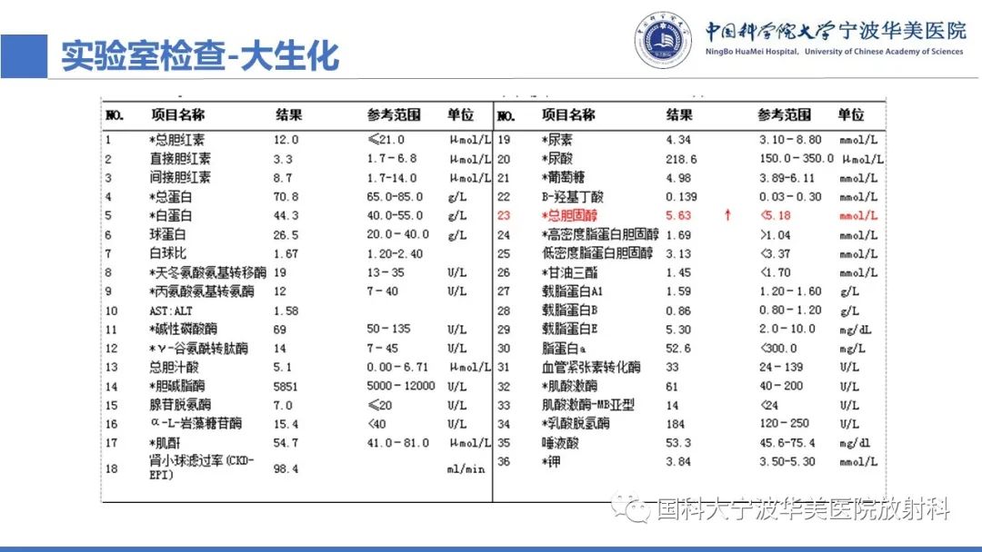 影像PPT - 【病例】骶椎脊索瘤1例CT及MR影像-5