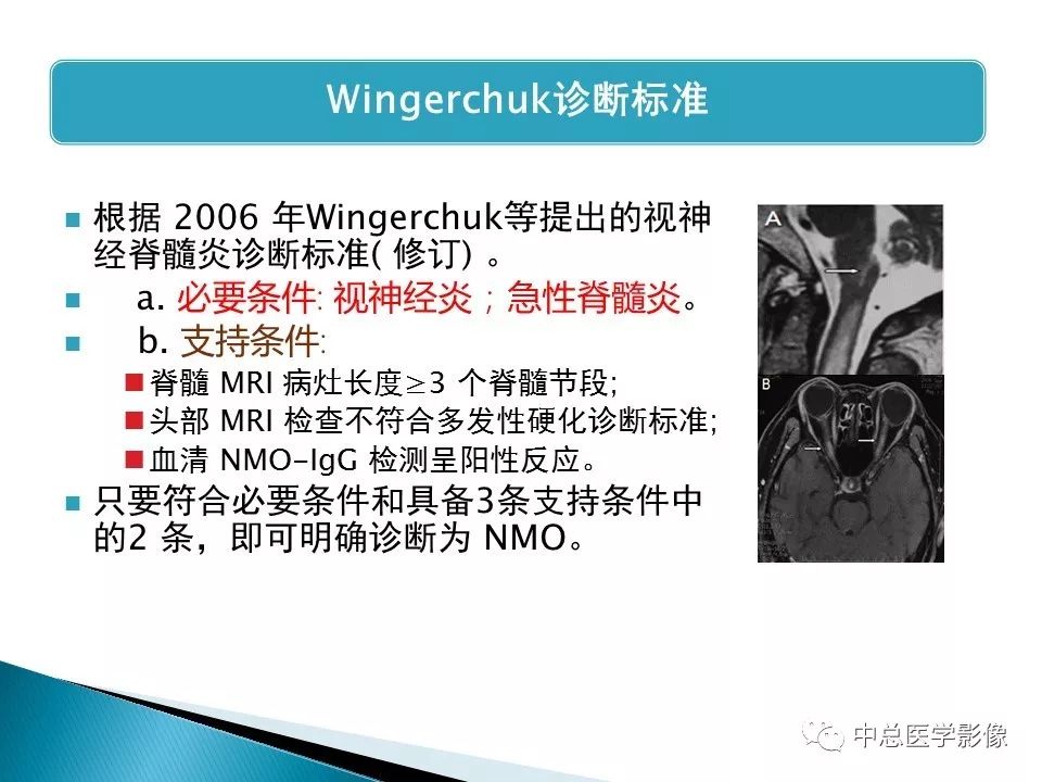 影像PPT - 【PPT】视神经脊髓炎：临床经过与MRI动态表现-40