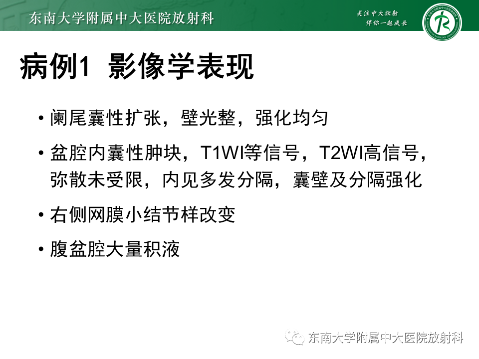 影像PPT - 【PPT】阑尾黏液性肿瘤-5 影像PPT - 【PPT】阑尾黏液性肿瘤-5
