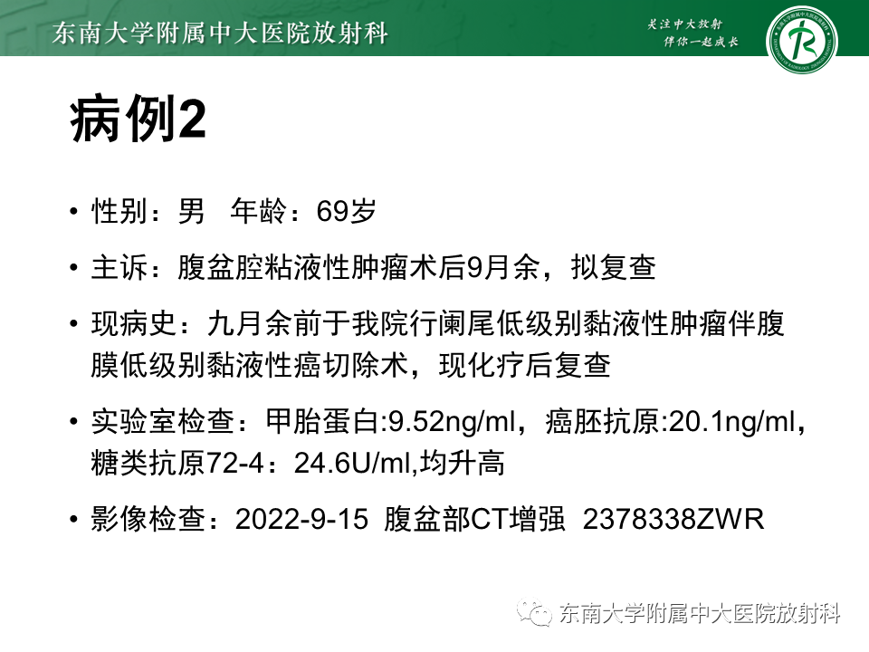 影像PPT - 【PPT】阑尾黏液性肿瘤-19 影像PPT - 【PPT】阑尾黏液性肿瘤-19