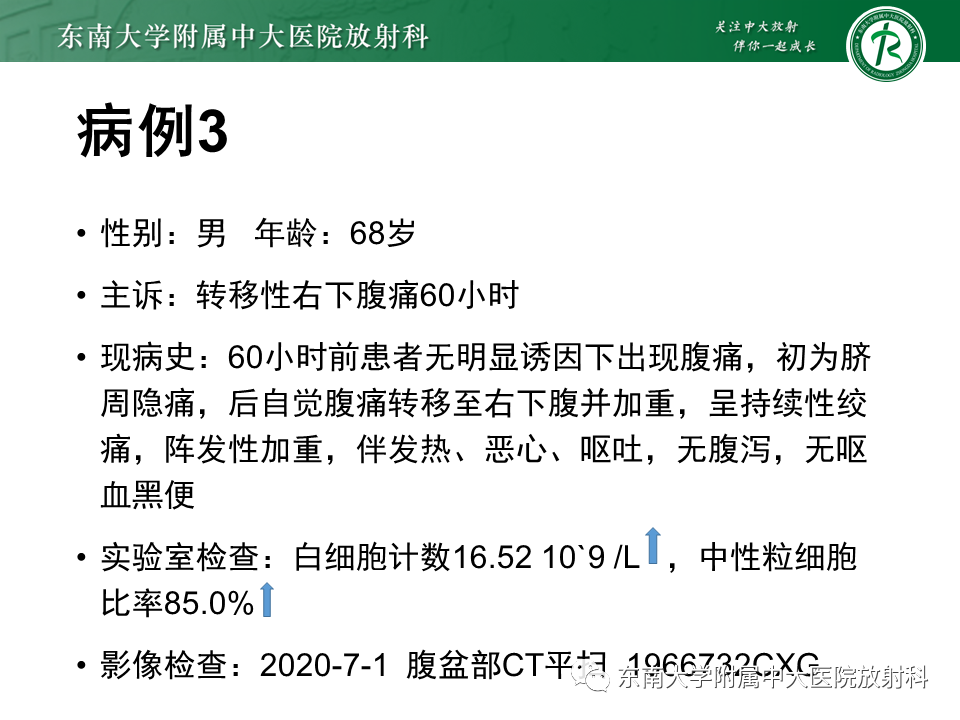 影像PPT - 【PPT】阑尾黏液性肿瘤-23 影像PPT - 【PPT】阑尾黏液性肿瘤-23