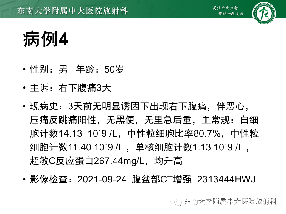 影像PPT - 【PPT】阑尾黏液性肿瘤-26 影像PPT - 【PPT】阑尾黏液性肿瘤-26