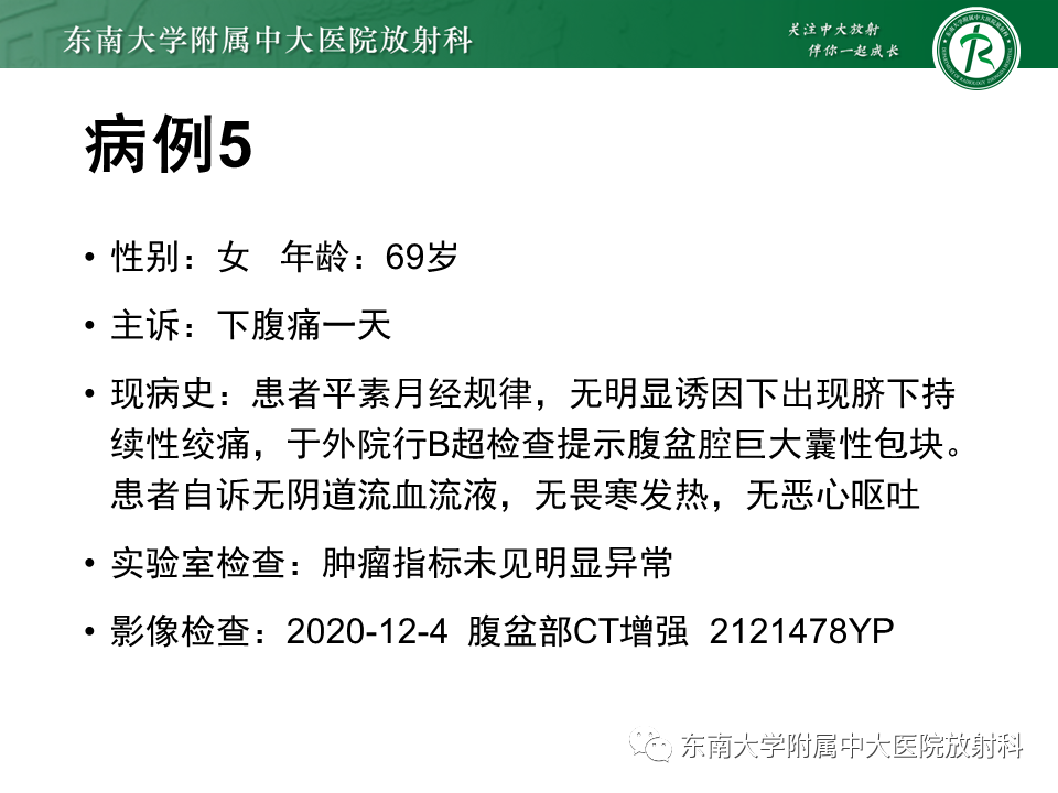 影像PPT - 【PPT】阑尾黏液性肿瘤-30 影像PPT - 【PPT】阑尾黏液性肿瘤-30