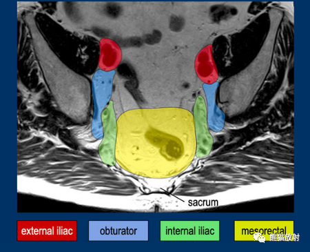 影像PPT - 直肠癌MRI-23 影像PPT - 直肠癌MRI-23