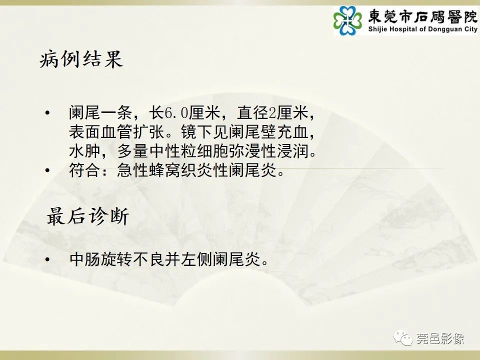 影像PPT - 【PPT】异位阑尾炎的CT诊断-8