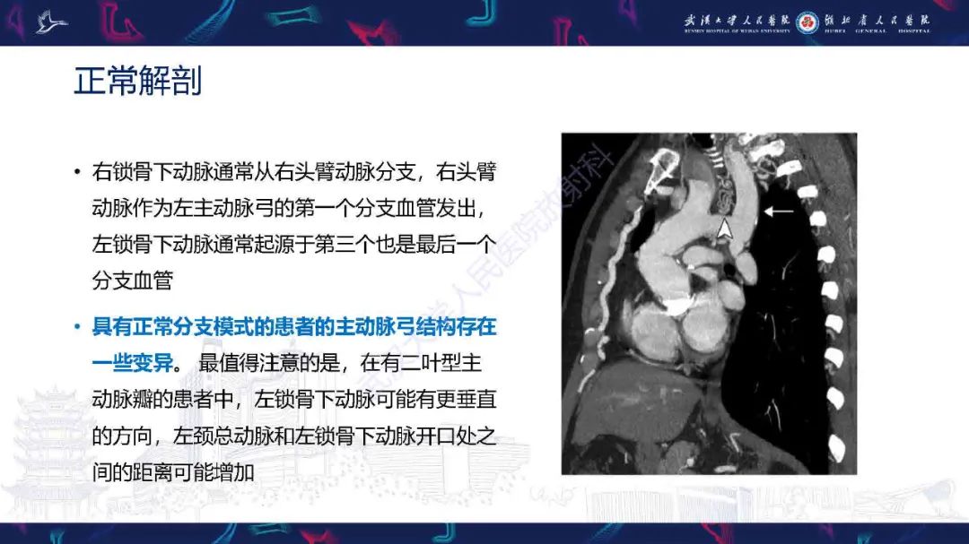 影像PPT - 【PPT】锁骨下动脉正常解剖及病变影像诊断-4