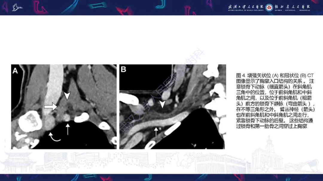 影像PPT - 【PPT】锁骨下动脉正常解剖及病变影像诊断-7