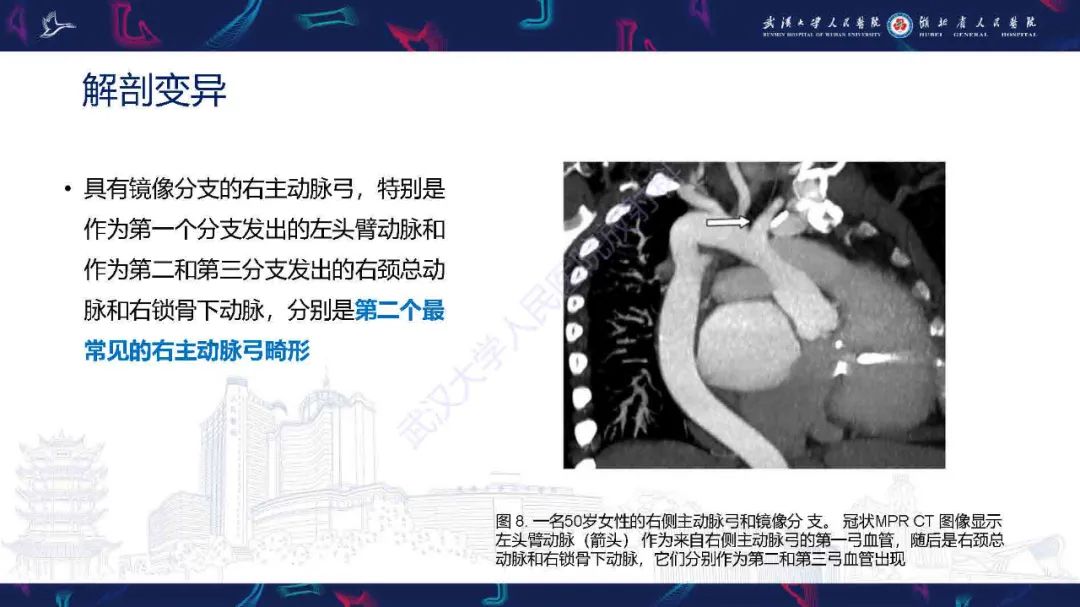 影像PPT - 【PPT】锁骨下动脉正常解剖及病变影像诊断-11