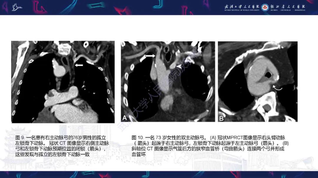 影像PPT - 【PPT】锁骨下动脉正常解剖及病变影像诊断-13
