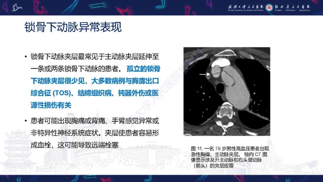 影像PPT - 【PPT】锁骨下动脉正常解剖及病变影像诊断-16