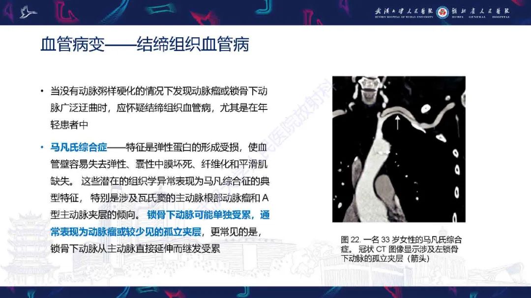 影像PPT - 【PPT】锁骨下动脉正常解剖及病变影像诊断-31