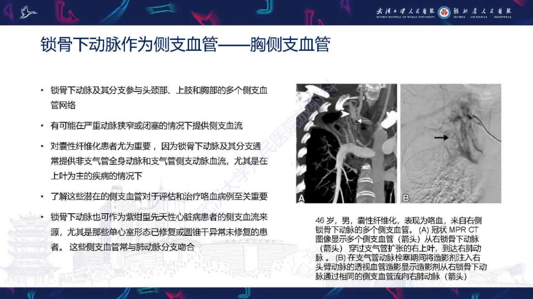 影像PPT - 【PPT】锁骨下动脉正常解剖及病变影像诊断-34