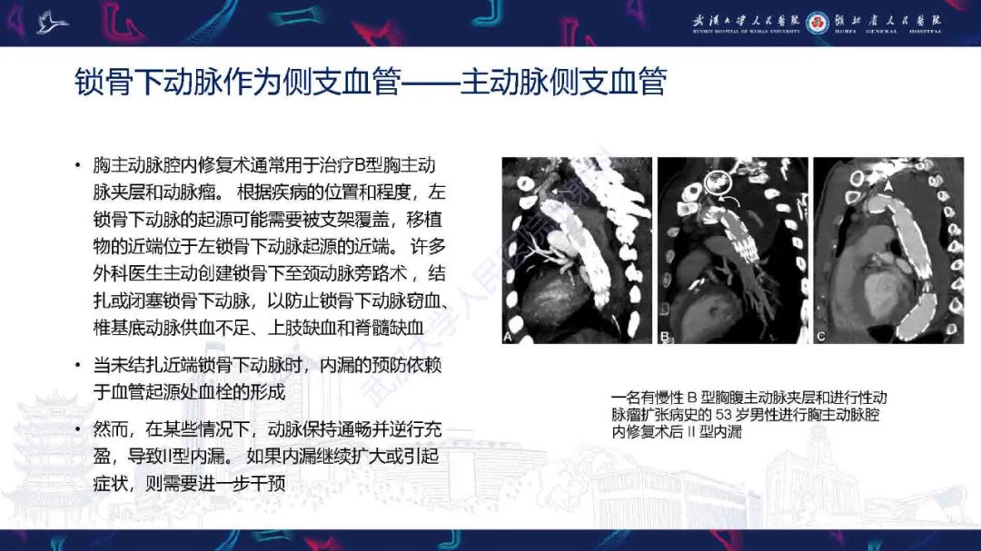 影像PPT - 【PPT】锁骨下动脉正常解剖及病变影像诊断-35